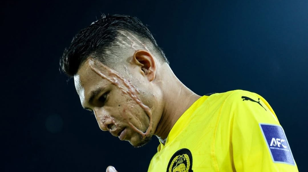 Зірка збірної Малайзії розповів про емоції, які він пережив після обливання кислотою