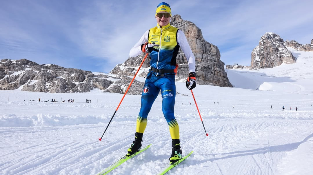 Возможно, не поверите, – Мандзин объяснил появление шрама на лице