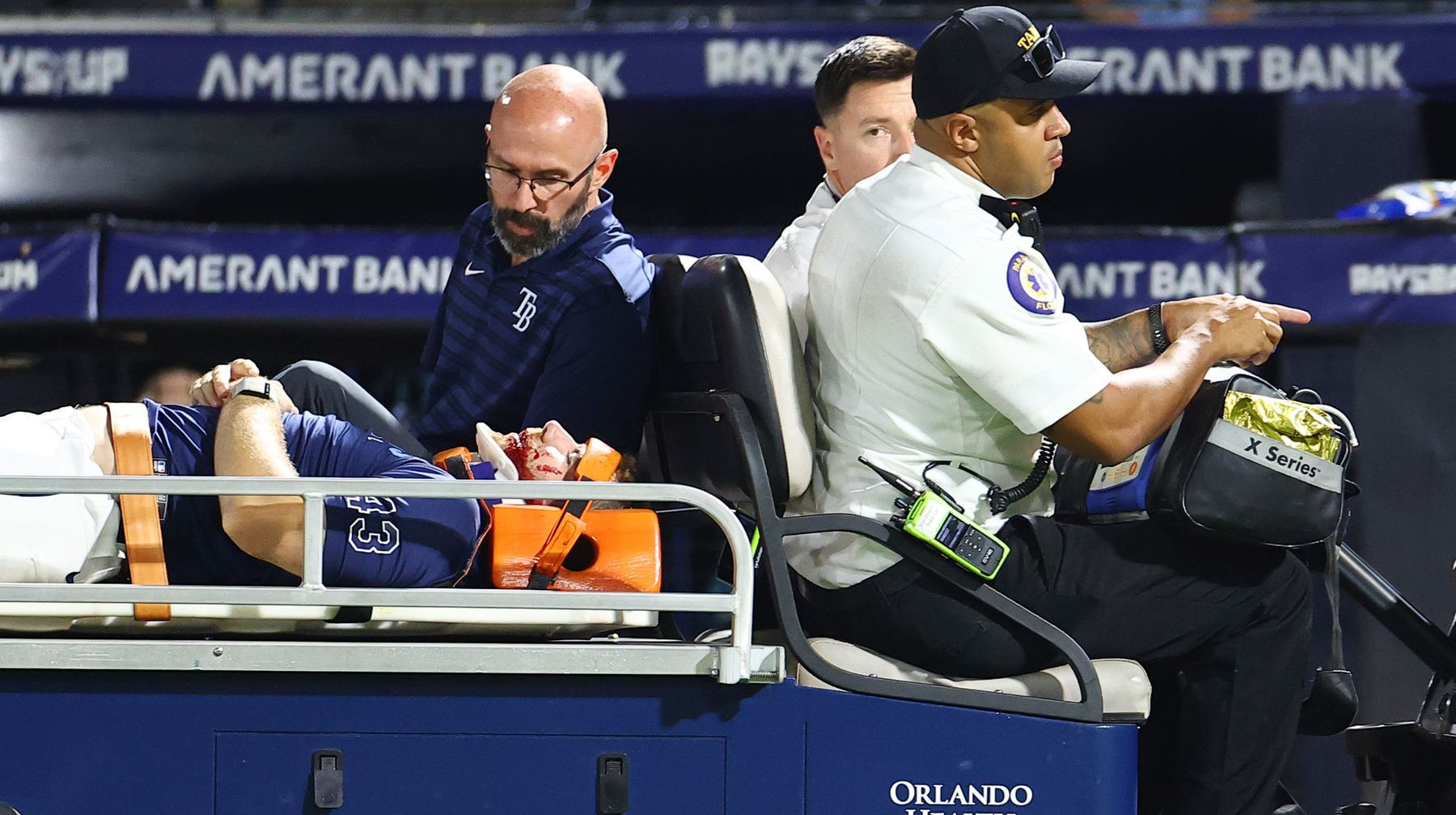 Швидкість 105 миль на годину: під час матчу МЛБ гравцеві м'яч розбив обличчя