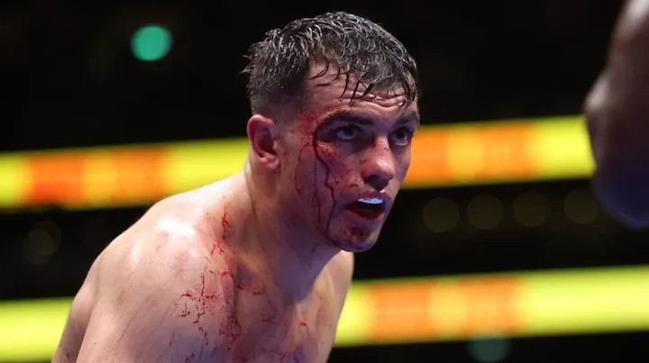 В андеркарді поєдинку Усика відбудеться чемпіонський бій