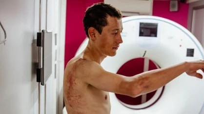 Екслідер Тур де Франс зійшов з гонки через важке падіння