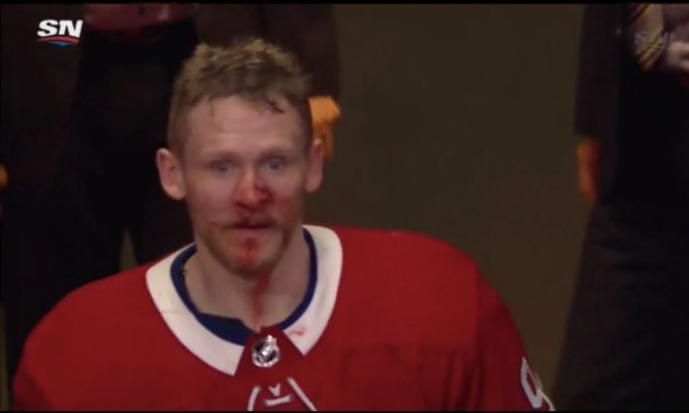 Кров залила обличчя російського хокеїста клубу НХЛ: Він хотів ударити суперника, але постраждав сам