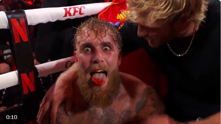 Менеджер Пола назвав строки відновлення Джейка після перелому щелепи