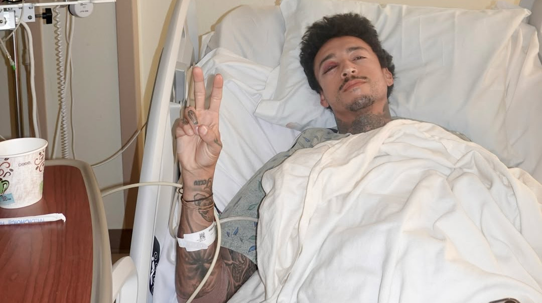 Перелом черепа та очниці: олімпійський медаліст Г'юстон отримав серйозну травму