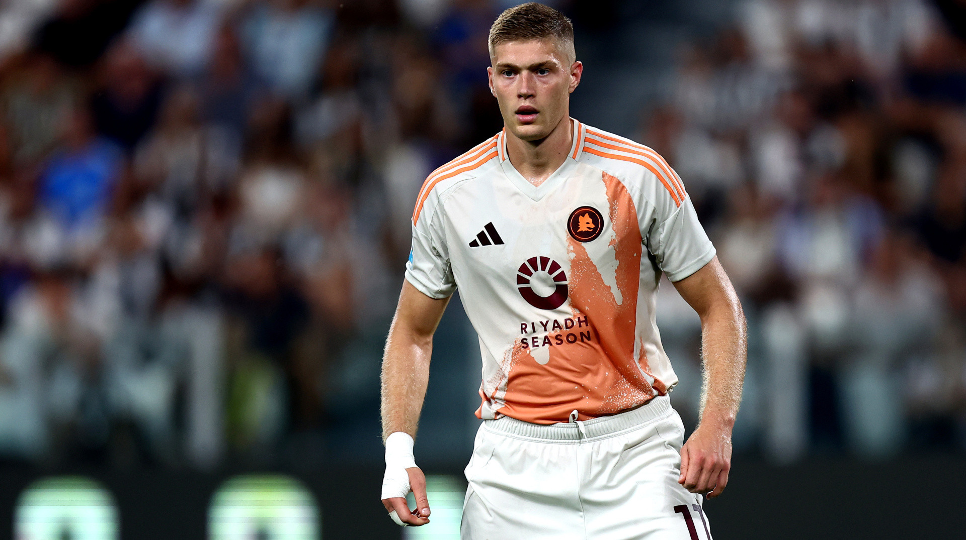 Ми трохи страждаємо, – Гасперіні розкрив деталі травми Довбика