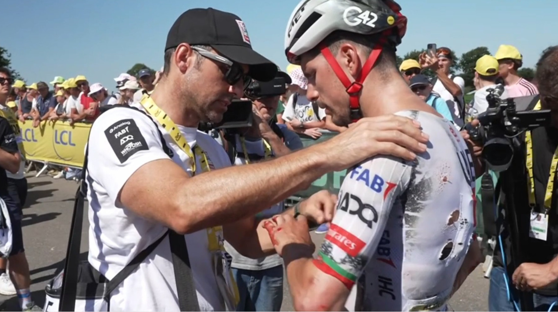 Алмейда продовжить боротьбу за Тур де Франс із переломом ребра