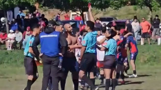 В стилі Зідана: футболіст жорстоко вибив судді зуби під час матчу в Уругваї