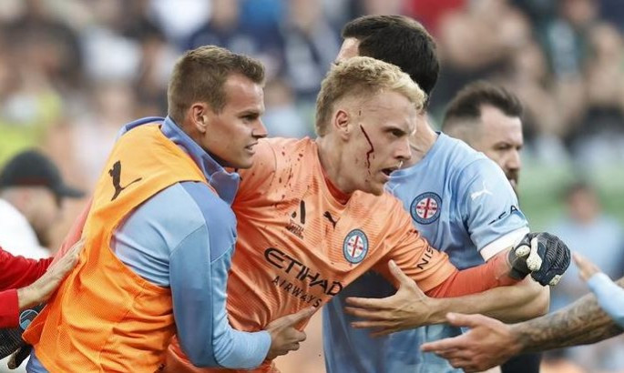 Вболівальник відром розбив обличчя воротарю Мельбурн Сіті під час дербі з Мельбурн Вікторі