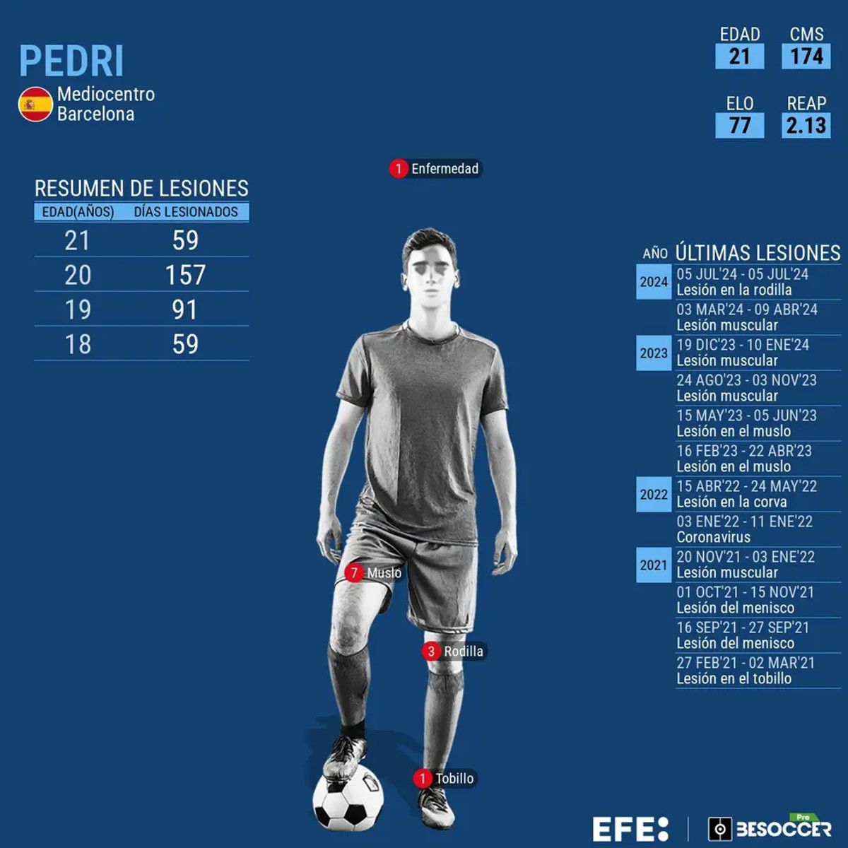 Травми Педрі у 2021-24 роках, opennemas.com